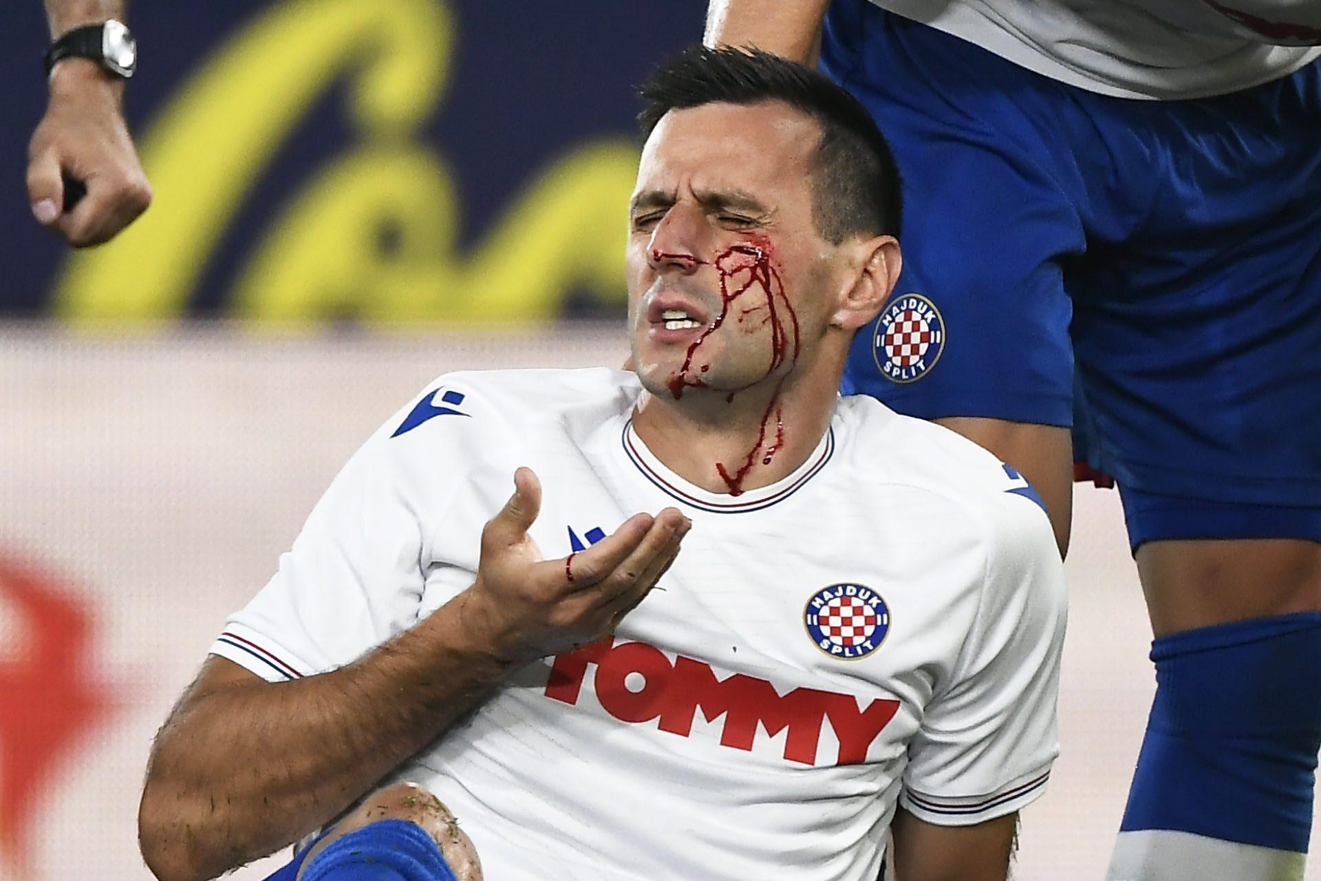 Slika