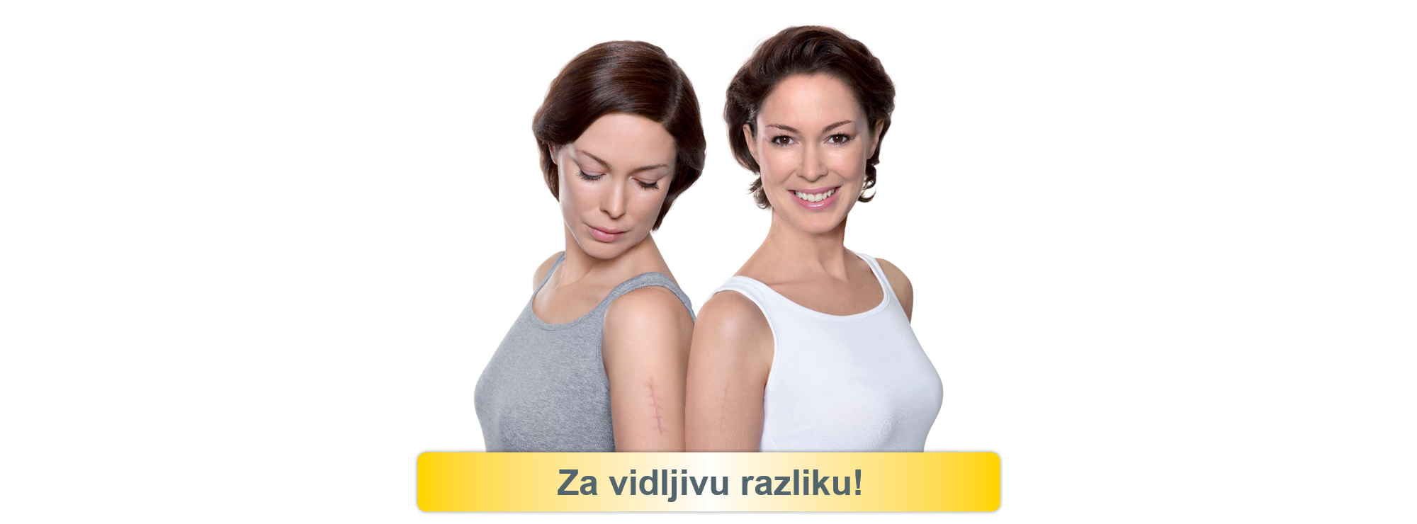 Contratubex - za vidljivu razliku 2