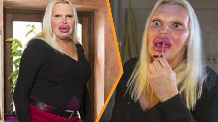 woman-spends-76k-get-perfect-female-body-heres-what-she-used-to-look-like0