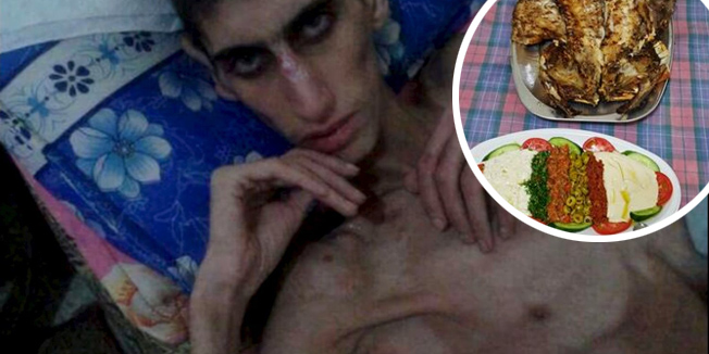 An emaciated man in Madaya is seen in this undated picture taken from social media. Warnings of widespread starvation are growing as pro-government forces besiege an opposition-held town in Syria and winter bites, darkening the already bleak outlook for peace talks the United Nations hopes to convene this month. To match MIDEAST-CRISIS/SYRIA-TOWN Handout via Social Media Websites/Syrian Observatory For Human Rights   ATTENTION EDITORS - THIS PICTURE WAS PROVIDED BY A THIRD PARTY. REUTERS IS UNABLE TO INDEPENDENTLY VERIFY THE AUTHENTICITY, CONTENT, LOCATION OR DATE OF THIS IMAGE. FOR EDITORIAL USE ONLY. NOT FOR SALE FOR MARKETING OR ADVERTISING CAMPAIGNS. THIS PICTURE IS DISTRIBUTED EXACTLY AS RECEIVED BY REUTERS, AS A SERVICE TO CLIENTS. EDITORIAL USE ONLY. NO RESALES. NO ARCHIVE.