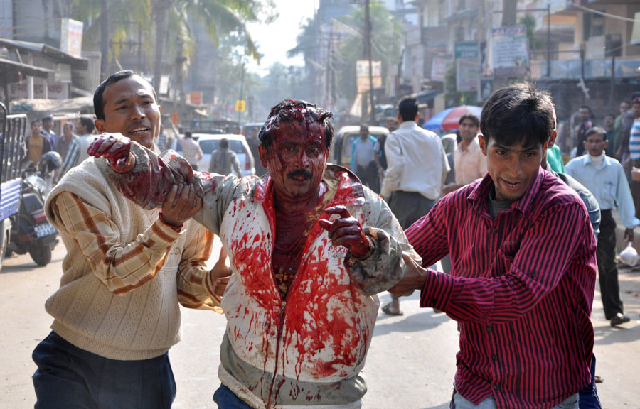 Two men help an injured person after he was attacked by a leopard (Panthera pardus) in a residential neighbourhood of Silphukhuri area in Guwahati on January 7, 2012. Three people were seriously injured in the leopard attack before the feline was tranquilized and taken to Assam state zoo. AFP PHOTO/STR