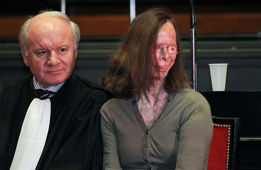 Lawyer Daniel Spreutels and Victim Patricia Lefranc attend the assize trial of Richard Remes, before the Assize Court of Brussels in Brussels, on March 12, 2012. Richard Remes is being accused of attempted murder, after he attacked his ex-girlfriend Patricia Lefranc by throwing acid in her face. BELGA PHOTO VIRGINIE LEFOUR