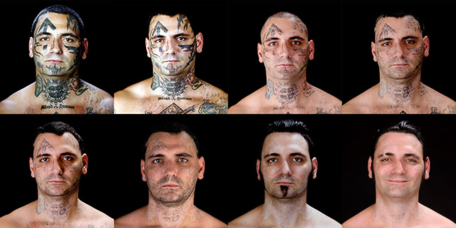 This combination of eight photos provided by Bill Brummel Productions shows the progress of tattoo removal treatments for former skinhead Bryon Widner. For 16 years, Widner was a glowering, swaggering, menacing vessel of savagery - an 