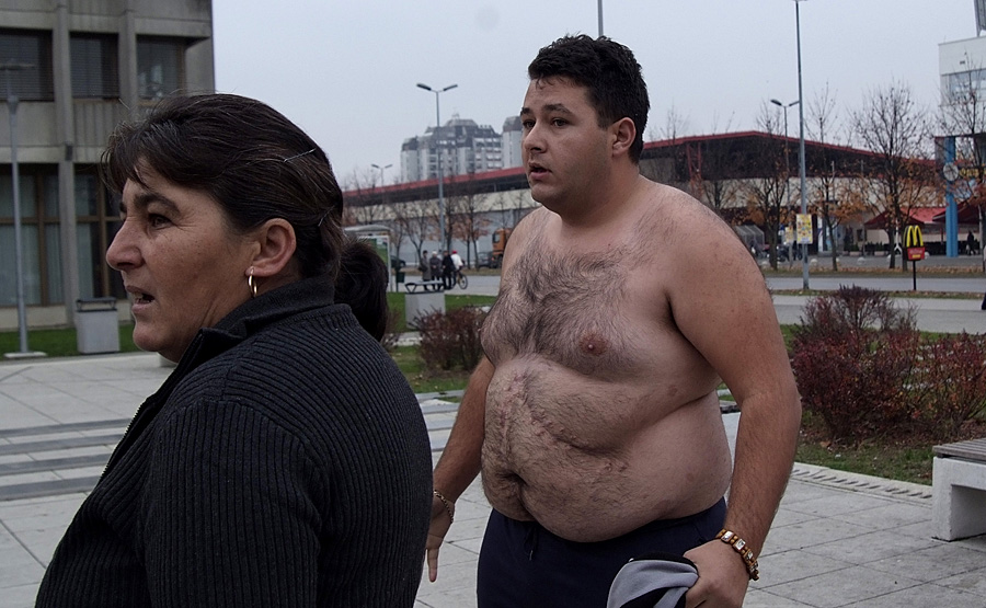 Karlovac, 081111.Frani Velicu dosudjeno je 6,5 godina zatvora a, njegov istoimeni sin je oslobodjen za pokusaj ubojstva brace Zorana i Zdravka Hudorovic u Ogulinu prosle godine. Ovaj je dogadjaj prethodio jos krvavijem obracunu Roma u Karlovcu u kojem je smrtno stradao Mate Velic. Nakon presude doslo je do verbalnog sukoba izmedju dvije obitelji ispred suda, pale su prijetnje novim krvoprolicem.Na slici: Sukob izmedju dvije obitelji, ranjeni Hudorovic.Foto: Robert Fajt / Cropix