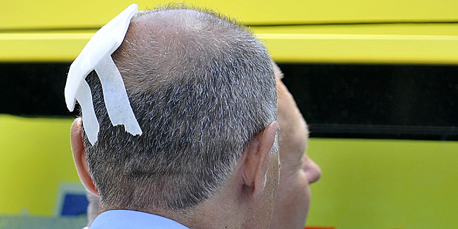 Zagreb, 290612.Na Hoto Busines Tower-u, u Savskoj 32, doslo je do puknuca vanjskog stakla, koje je palo po plocniku, te je lakse ozlijedilo djelatnika zastitarske tvrtke, kojemu je hitna pomoc na mjestu dogadjaja sanirala ozljedu glave.Na fotografiji: Ozlijedjeni zastitar.Foto: Admir Buljubasic / CROPIX