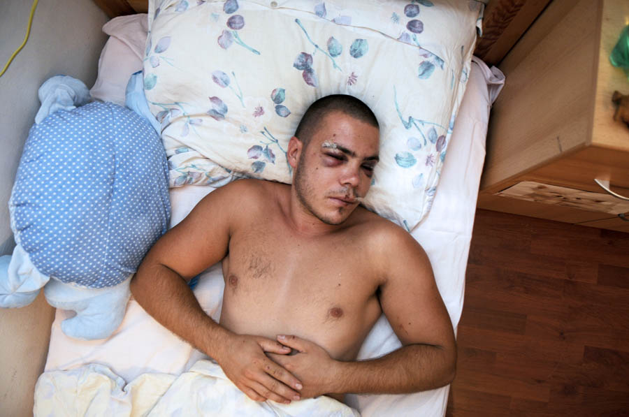 Sibenik, 170812.U klubu Hacijenda, u Vodicama, prije dva dana zastitari su brutalno pretukli Narda Prelevica.Foto: Nikolina Vukovic Stipanicev / SIBENSKI LIST / CROPIX