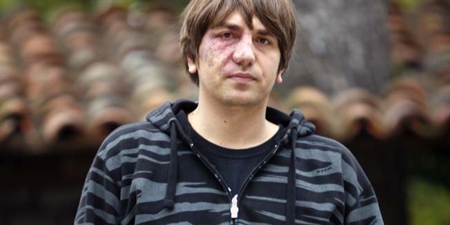 Opatija, 020111.Damir Tomic, jedan od organizatora opatijskog doceka Nove godine na Ljetnoj pozornici, udaren je u glavu od strane policijskog djelatnika oko 3 ujutro 01.01. nasred pozornice na Ljetnoj. Tomic je potom uhicen i pripracen u policijsku postaju Opatija gdje je zadrzan do popodneva i gdje su ga, prema njegovim tvrdnjava, dodatno istukli.Foto: Tea Cimas / CROPIX