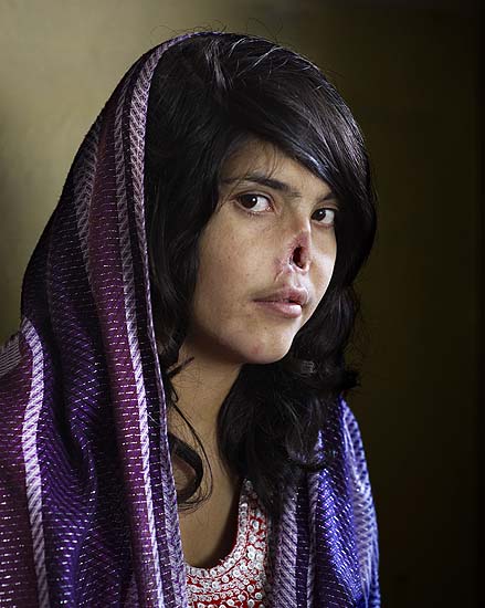 In this photo provided by World Press Photo shows the World Press Photo of the Year 2010 by Jodi Bieber, South Africa, Institute for Artist Management for Time magazine, Bibi Aisha, an 18-year-old woman from Oruzgan province in Afghanistan, who fled back to her family home from her husbandÕs house, complaining of violent treatment. The Taliban arrived one night, demanding Bibi be handed over to face justice. After a Taliban commander pronounced his verdict, Bibi's brother-in-law held her down and her husband sliced off her ears and then cut off her nose. Bibi was abandoned, but later rescued by aid workers and the American military. After time in a women's refuge in Kabul, she was taken to America, where she received counseling and reconstructive surgery. Bibi Aisha now lives in the US. (AP Photo/Jodie Bieber/Institute for Artist Management/Goodman Gallery for Time magazine) NO SALES, THIS MATERIAL IS FOR SINGLE USE PUBLICATIONS IN PRINT OR FOR A TEMPORARY ONLINE PUBLICATION, AND MAY BE USED EXCLUSIVELY TO PUBLICIZE THE 2011 WORLD PRESS CONTEST AND EXHIBITION. IT MAY NOT BE PUBLISHED AS PART OF AN ARTICLE OR ANY OTHER ITEM THAT CONTAINS NO DIRECT LINK TO WORLD PRESS PHOTO AND ITS ACTIVITIES. THE PICTURE MAY NOT BE CROPPED OR MANIPULATED IN ANY WAY. AP PROVIDES ACCESS TO THIS PUBLICLY DISTRIBUTED HANDOUT PHOTO TO BE USED ONLY TO ILLUSTRATE NEWS