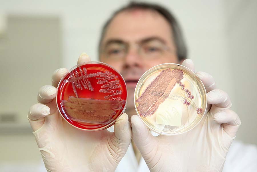 Helmut Fickenscher, director of the institute for infection medicine at the university clinic of Schleswig-Holstein, holds petri dishes with colonies of the virulent E. coli bacteria (EHEC) on June 1, 2011 at the insitute's laboratory in Kiel, northern Germany. The number of people sickened by a mysterious killer bacteria grew, two weeks after the outbreak in Germany, while fears over tainted vegetables hit European farmers hard. Scientists and health officials say they have identified the E. coli bacteria (EHEC) responsible for the outbreak, which has mainly affected northern Germany, but are unable to say what caused it or who was responsible.     AFP PHOTO    BODO MARKS    GERMANY OUT