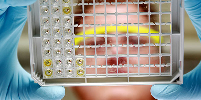 Samples of vegetables are tested for the enterohaemorrhagic E. coli (EHEC) bacteria in a laboratory at the chemical and veterinary examination office Rhein-Ruhr-Wupper in the western German city of Krefeld on June 7, 2011.The source of the killer bacteria remained elusive after Germany announced that initial tests on suspected organic sprouts had proved negative and the outbreak's death toll grew to 23. Some 2,000 people have become ill across Europe from the enterohaemorrhagic E. coli (EHEC) outbreak which has affected 12 countries. AFP PHOTO / ROLAND WEIHRAUCH  GERMANY OUT