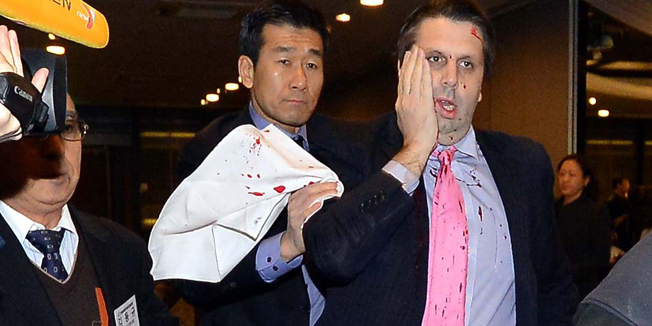 This handout photo taken and released on March 5, 2015 by South Korean local newspaper the Asia Economy Daily shows US ambassador to South Korea Mark Lippert (R) covering a wound to his face as he leaves the Sejong Cultural Institute in Seoul, after he was injured in an attack by an armed assailant. Lippert was slashed on his face and arm by a blade-wielding assailant shouting anti-war slogans in an attack in Seoul on March 5, police and reports said.  REPUBLIC OF KOREA OUT      ---- EDITORS NOTE ---- RESTRICTED TO EDITORIAL USE   MANDATORY CREDIT 