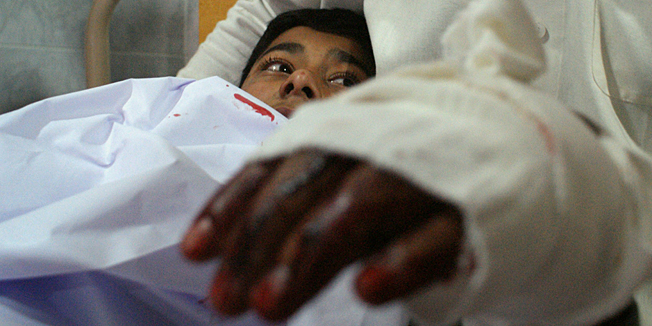 An injured Pakistani student lies in bed at a hospital following an attack by Taliban gunmen on a school in Peshawar on December 16, 2014. Taliban insurgents killed at least 130 people, most of them children, after storming an army-run school in Pakistan December 16 in one of the country's bloodiest attacks in recent years. AFP PHOTO/ A MAJEED