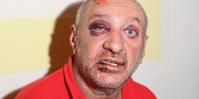 Biograd, 211214.52 godisnji Morina Ruzdin pretucen je u petak poslijepodne u policijskoj postaji u Biogradu nekoliko trenutaka nakon sto je tamo dosao prijaviti prijetnju. Dok je cekao da ga policajac primi u postaju je uletio 42 godisnji A. B. koji mu je prethodno prijetio. Nakon sto je izudarao Ruzdina, 42 godisnjak je uhicen i prekrsajno prijavljen.Foto: Jure Miskovic / CROPIX