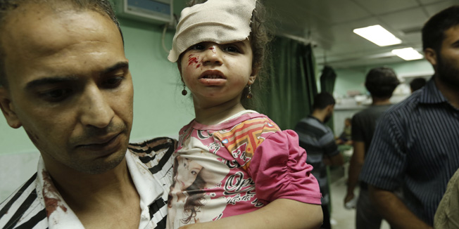 A Palestinian child (C), wounded in an Israeli strike on a compound housing a UN school in Beit Lahia in the northern Gaza Strip, receives treatment at Kamal Edwan hospital in Beit Lahia early on July 30, 2014.  Israeli bombardments early on July 30 killed 