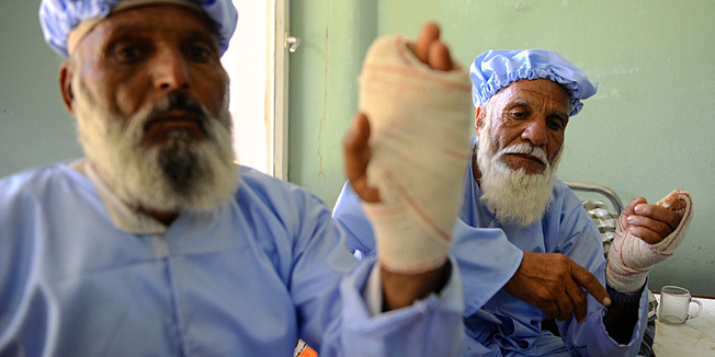 Afghan residents sit in a hospital ward after insurgents cut off their fingers in Herat on June 15, 2014. Eleven voters in the western province of Herat had their fingers -- which were dipped in ink to register their ballot -- cut off by insurgents, Deputy Interior Minister Ayoub Salangi said on his Twitter account. Millions of Afghan voters defied Taliban threats and attacks to vote in a presidential run-off election securing the country's first democratic transfer of power. AFP PHOTO/AREF KARIMI