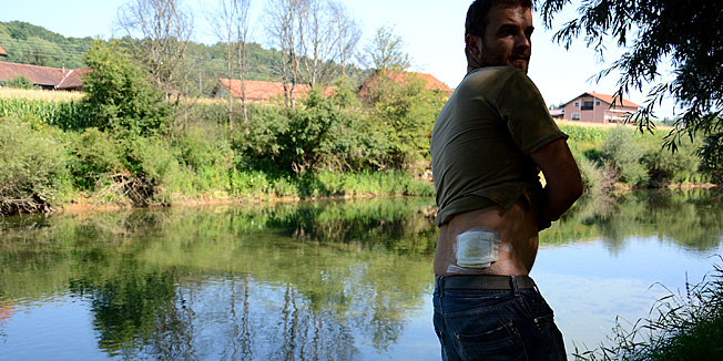 Karlovac, 260713.Krunoslava Zovka (34) u rijeci Dobri na kupalistu kod Fanjka u mjestu Zadobarje, oko pet kilometara zapadno od Karlovca u subotu 20.07. napao je dabar, te ga je ugrizao za donji desni dio ledja. Krunoslav je zbog toga zatrazio hitnu medicinsku pomoc i jos uvijek je na lijekovima.Na fotografiji: Krunoslav Zovko, djelatnik u telekomunikacijskom poduzecu.Foto: Matio Pusic / Cropix