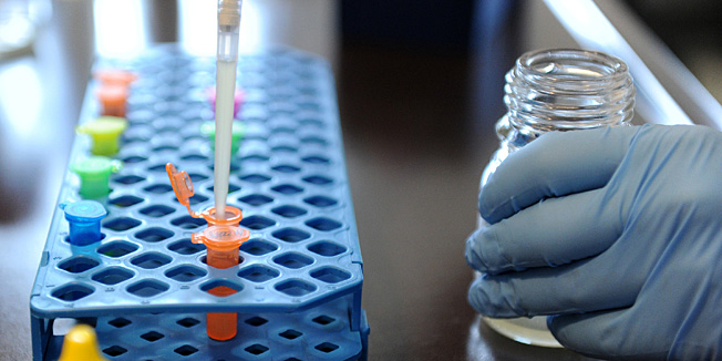 An employee of the veterinarian institute in Hanover, central Germany, prepares a quick test for the identification of the pathogenic agent in the virulent E. coli bacteria (EHEC) on June 1, 2011. The number of people sickened by a mysterious killer bacteria grew, two weeks after the outbreak in Germany, while fears over tainted vegetables hit European farmers hard. Scientists and health officials say they have identified the E. coli bacteria (EHEC) responsible for the outbreak, which has mainly affected northern Germany, but are unable to say what caused it or who was responsible.     AFP PHOTO    CAROLINE SEIDEL    GERMANY OUT