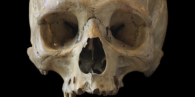Skull of the person close-up on a black background.
