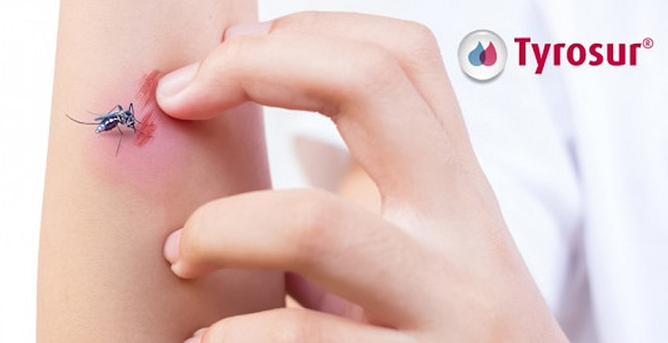 tyrosur1-648x275_png.bin