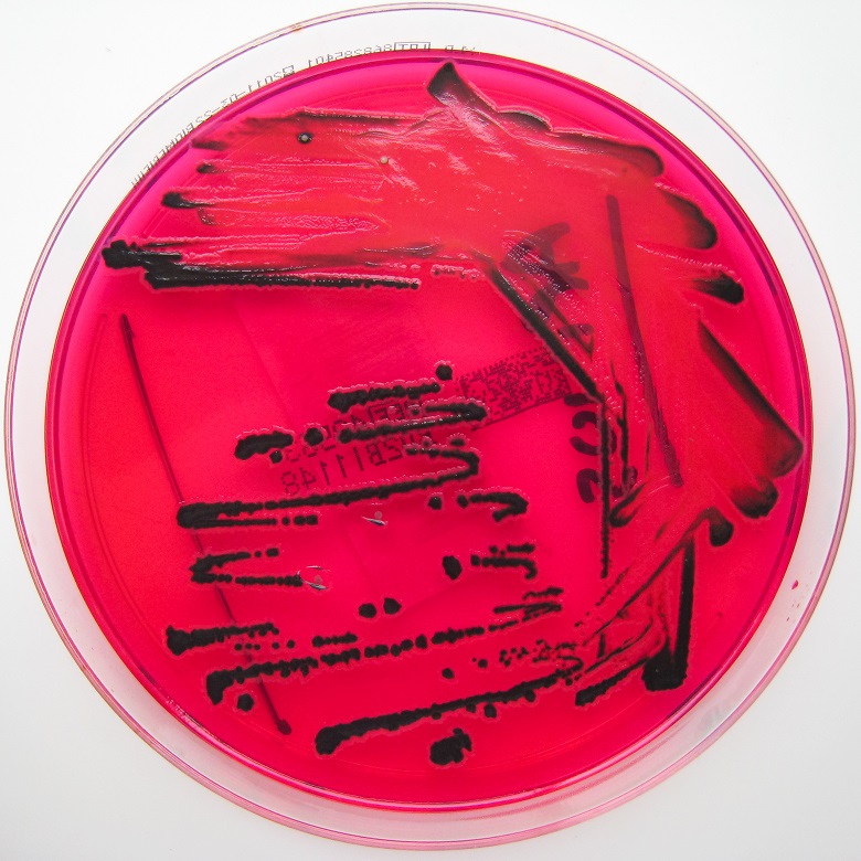 Salmonella_species_growing_on_XLD_agar_-_Showing_H2S_production_1