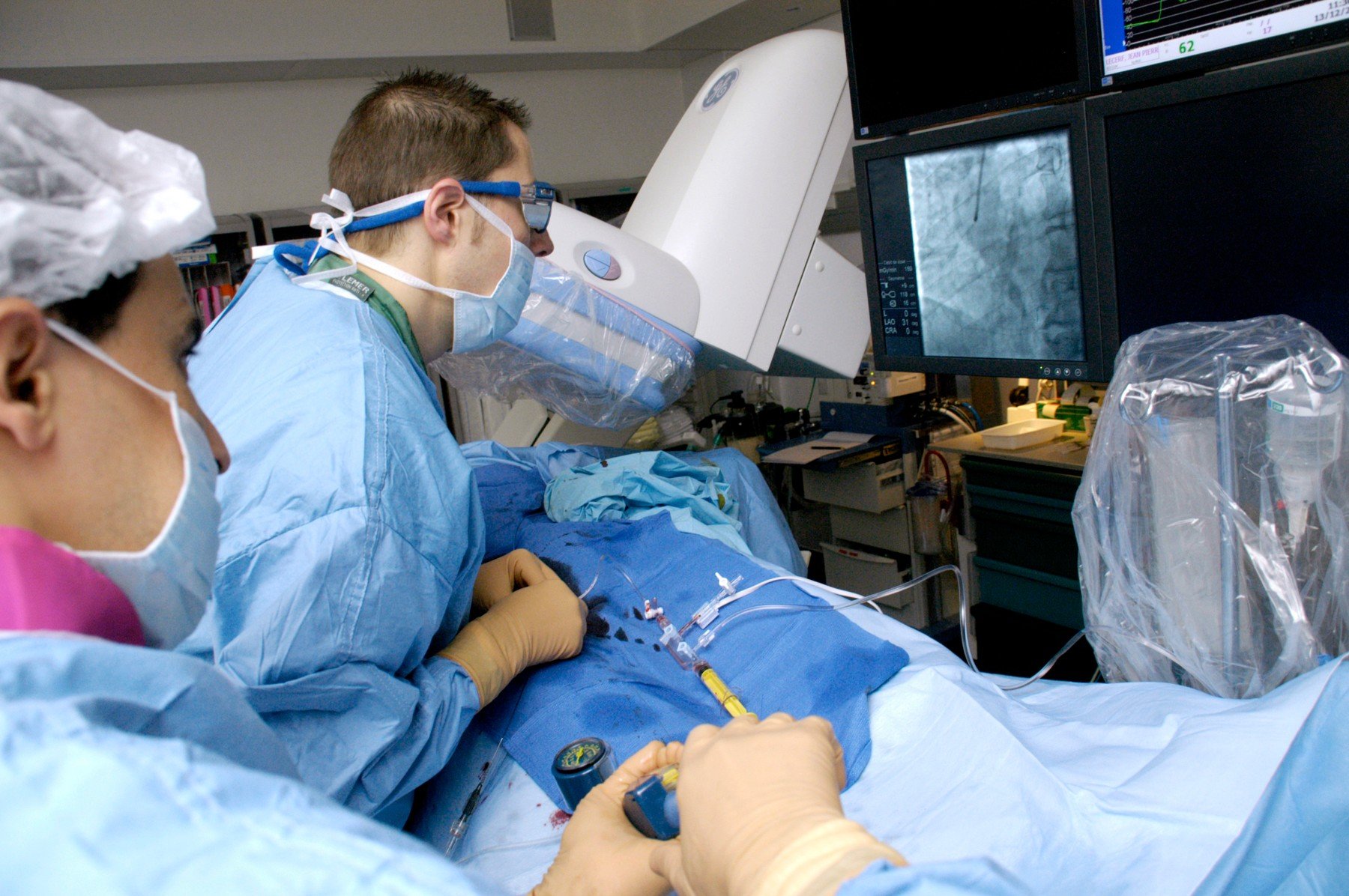 Ilustracija, ugrađivanje stenta