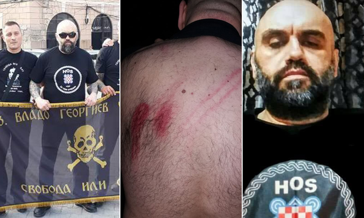 Georgiev, kako se na Facebooku predstavlja, voli objavljivati fotografije, pa je tako objavio i ovu u kojoj se vide tragovi policijskog pendreka na leđima (u sredini)