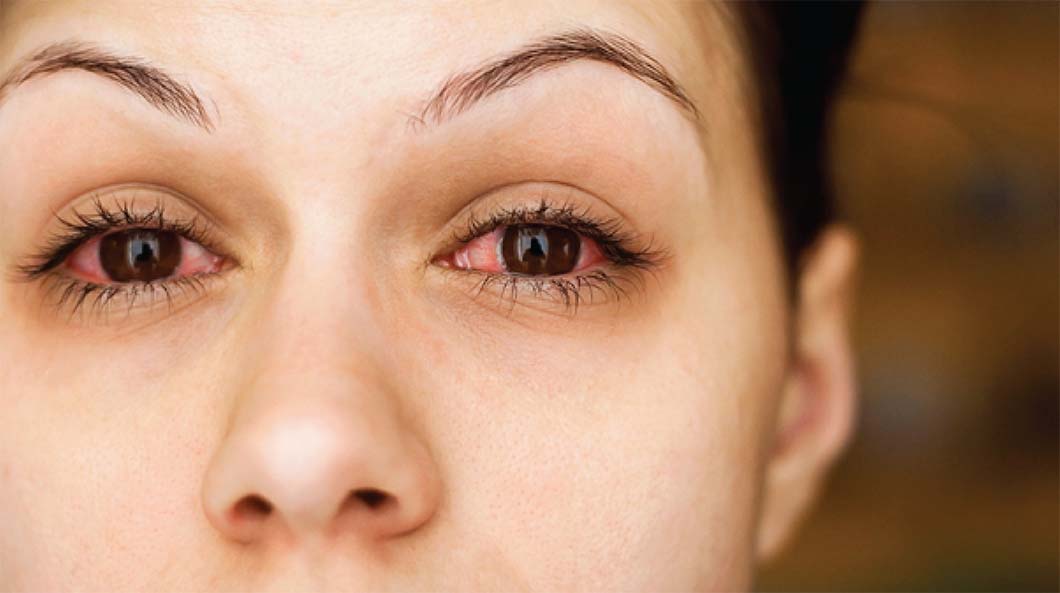 leće-jutarnji-1060x450-6