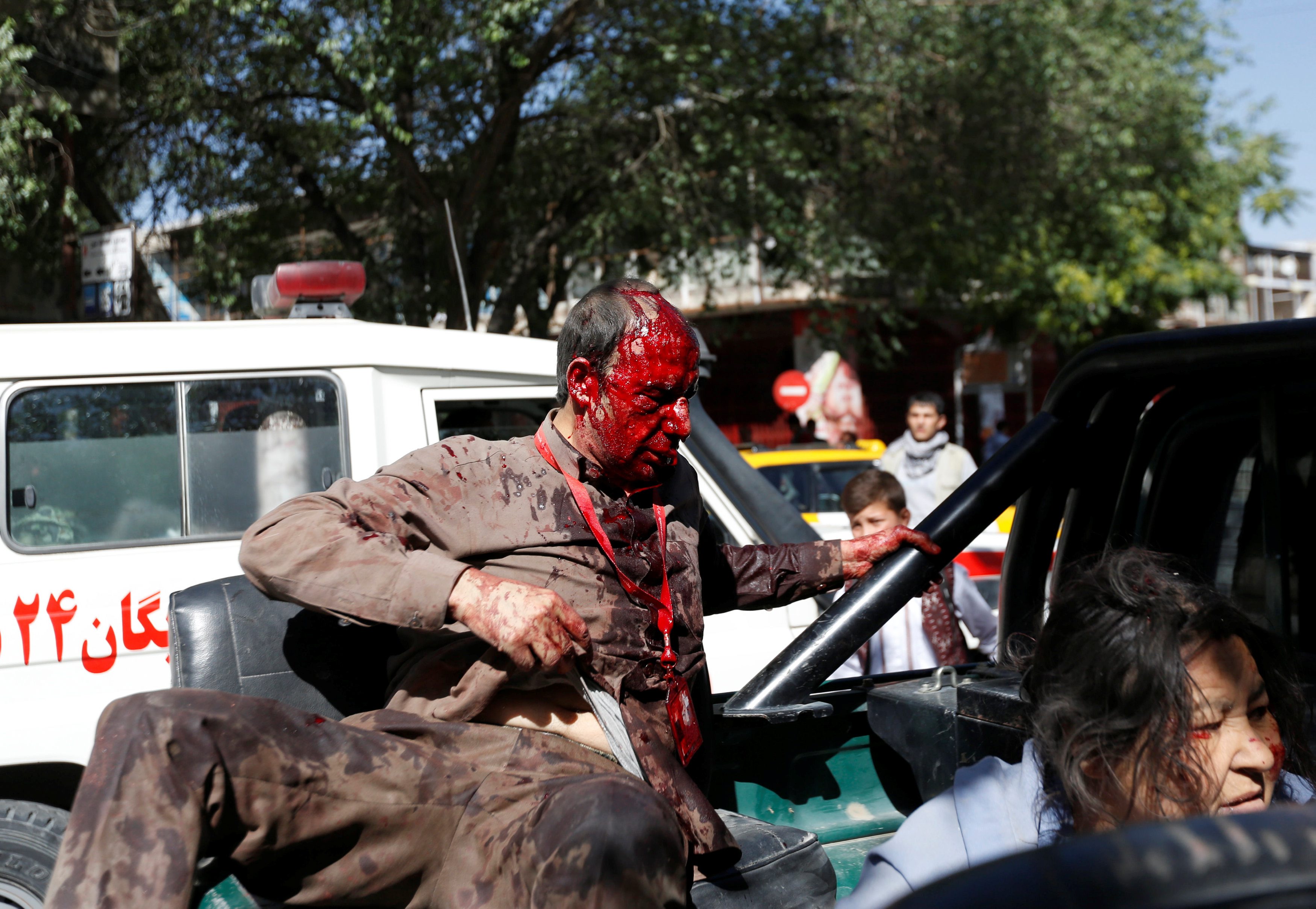 2017-05-31T051458Z_99364829_RC1CBE4CFA50_RTRMADP_3_AFGHANISTAN-BLAST