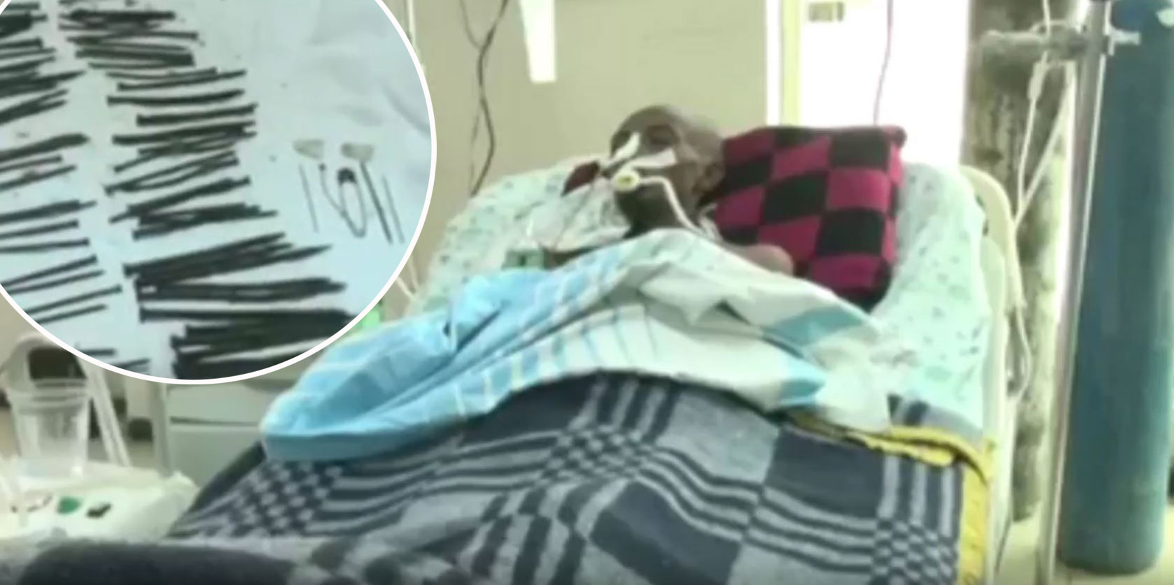 adis-abeba-čavli-operacija