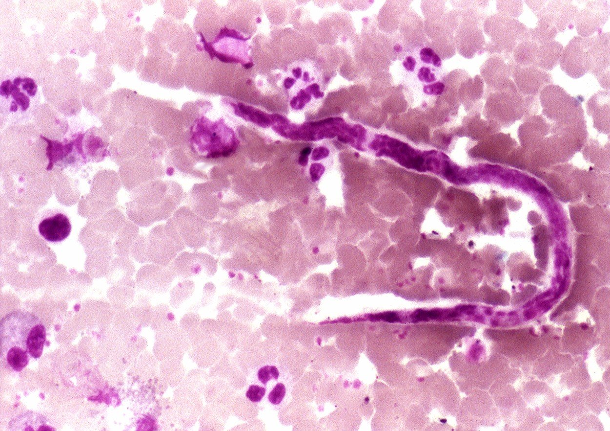 Parazit Onchocerca volvulus