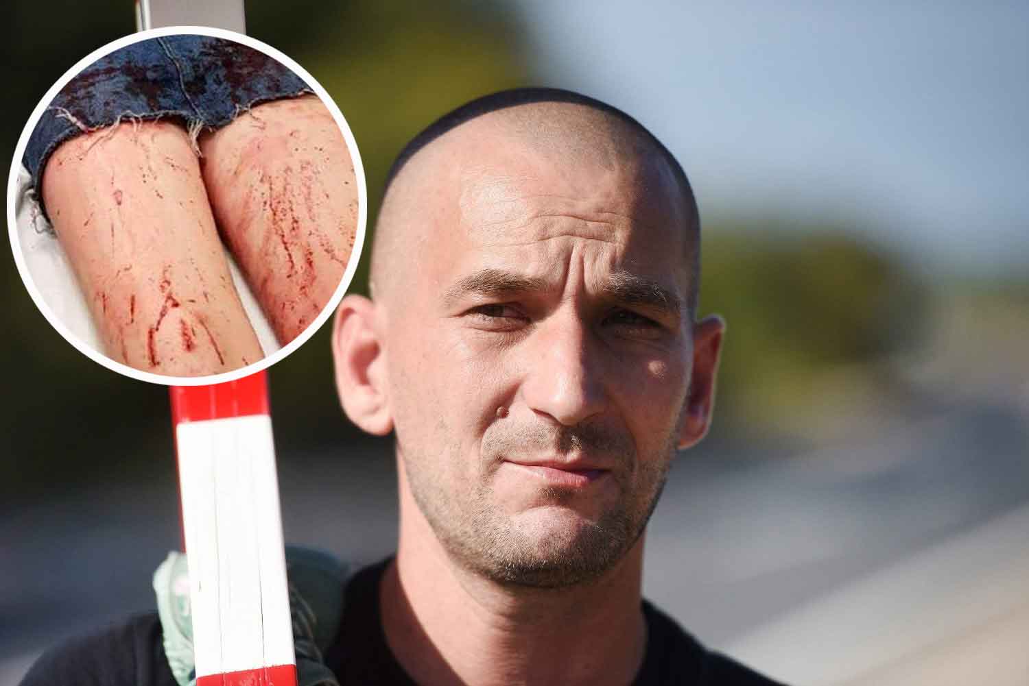 Josip Deur; pretučena djevojka (u krugu)