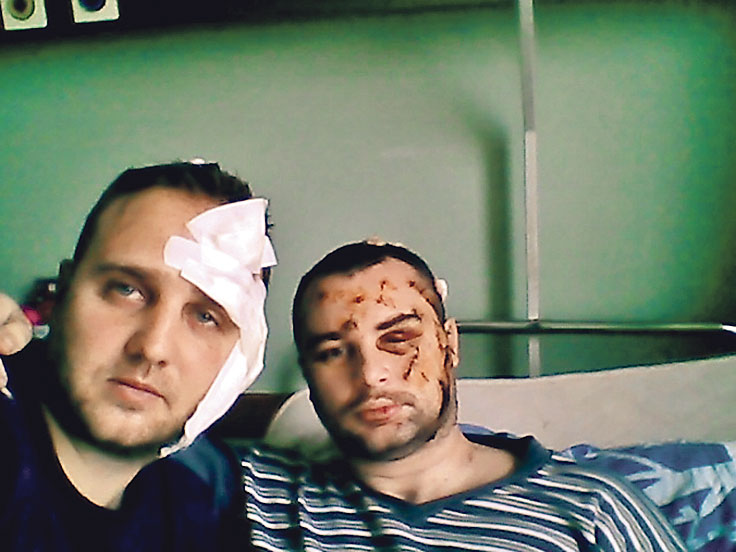 Policajca Vladimira Nedeljkovića (u prugastoj pidžami) šestorica muškaraca isjekla su po licu, a pravosudnom policajcu Miroslavu Manjošu  bocom su odsjekli uho