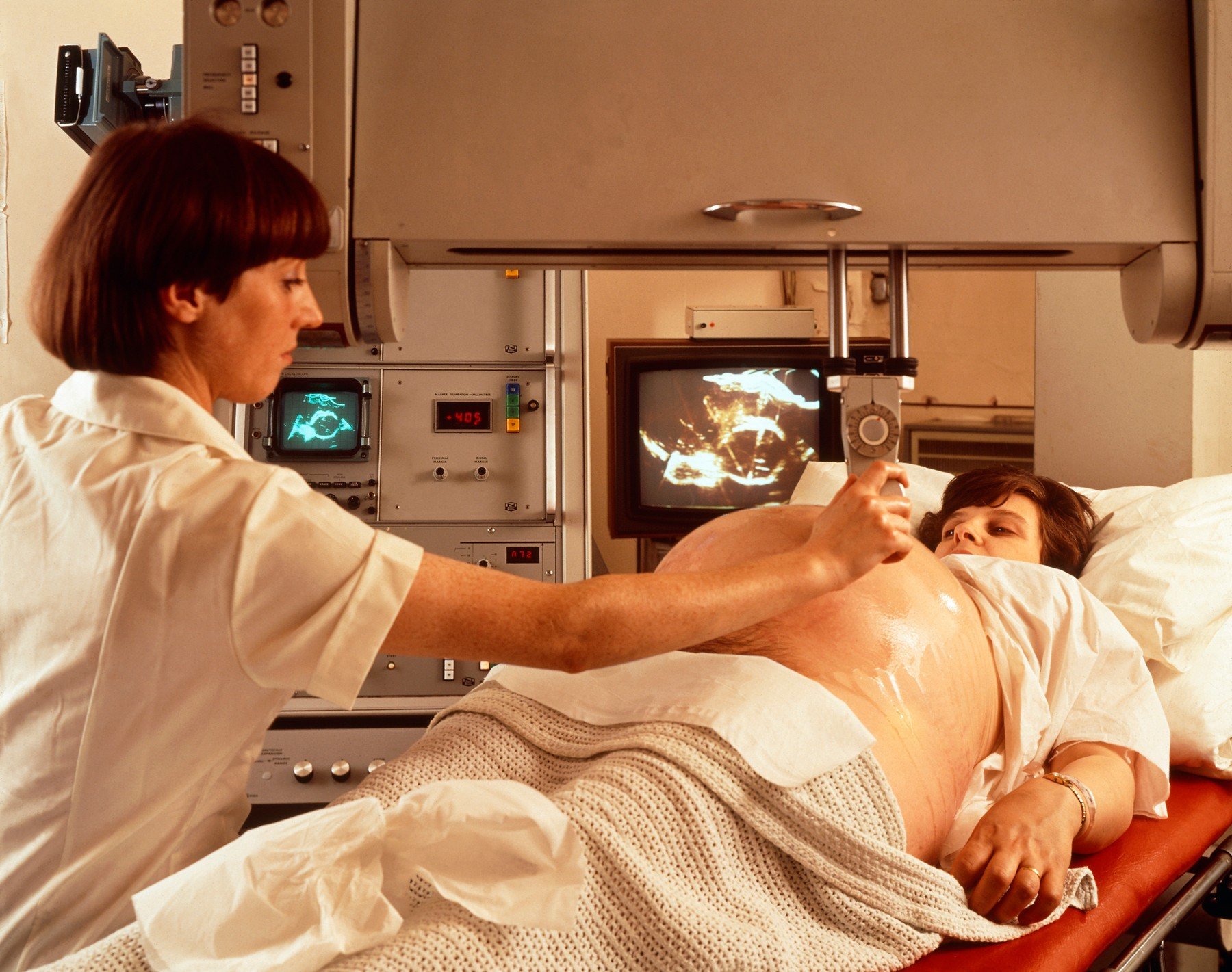 profimedia-0102356692