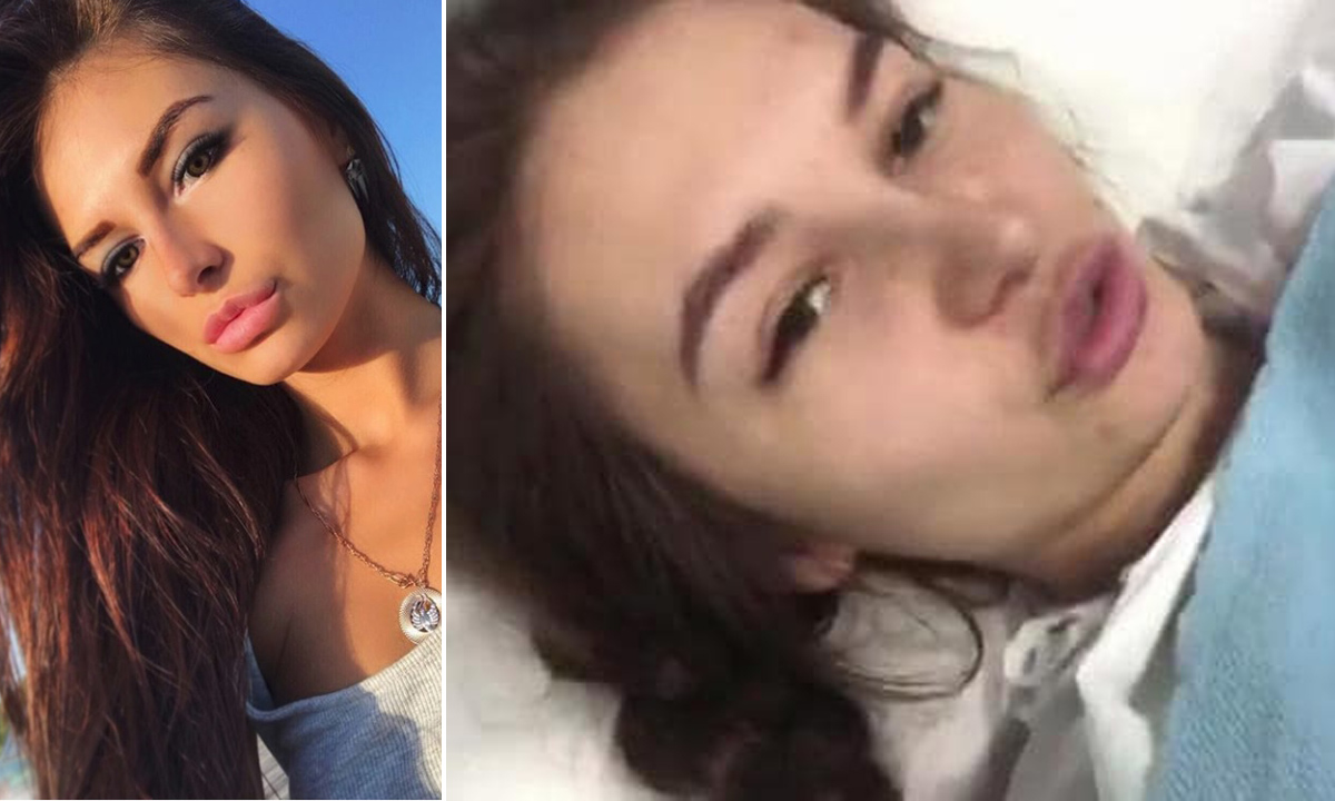 Ekaterina Stetsjuk prije nesreće (lijevo) i u bolničkom krevetu (desno)