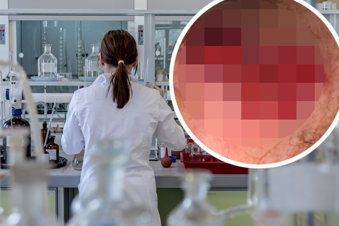 buruli čir laboratorij