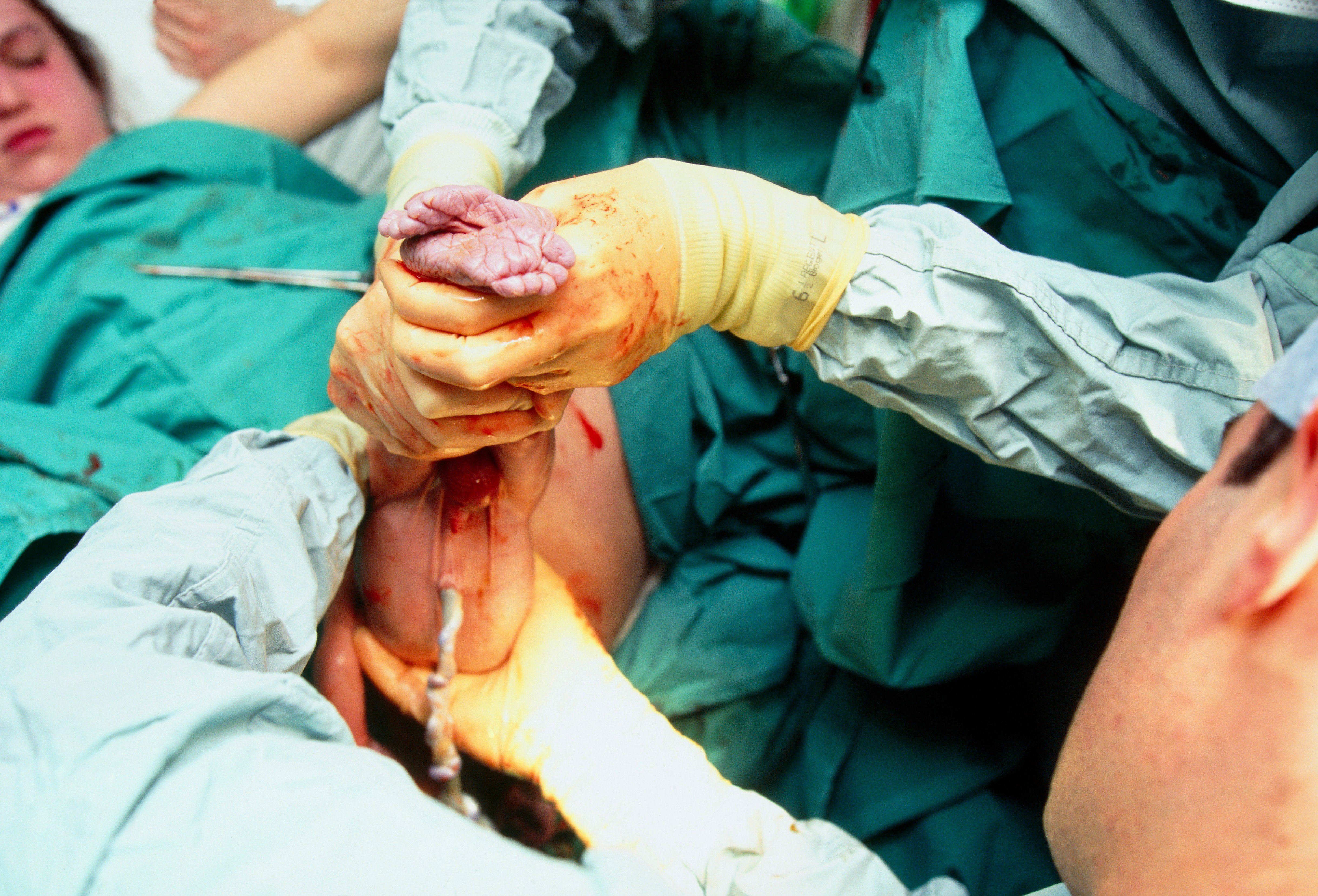 profimedia-0102408081