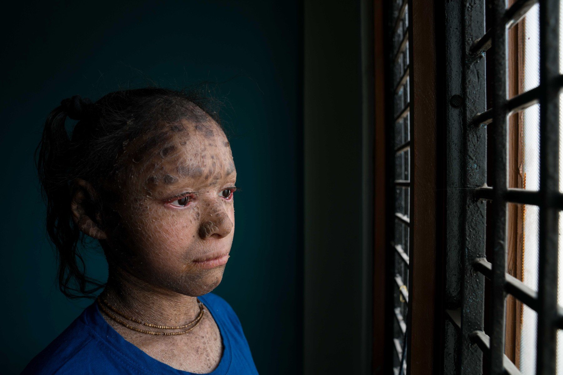 profimedia-0370243501