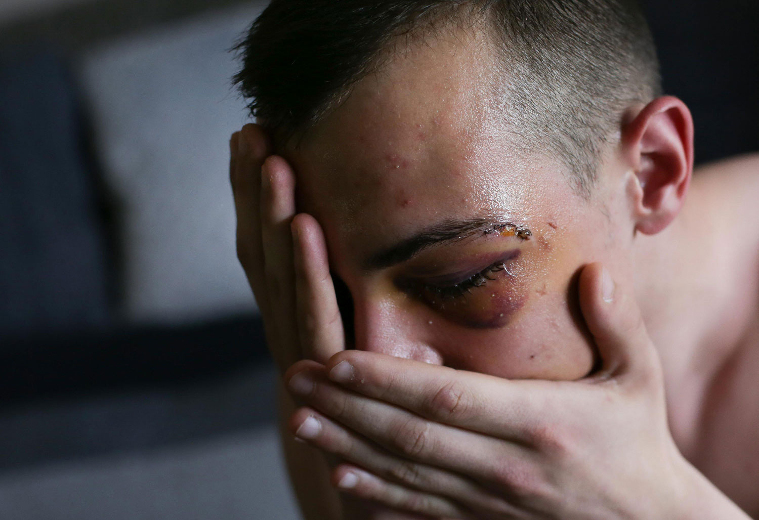 Maloljetni mladić je tijekom pregleda u Hitnoj dva puta povratio