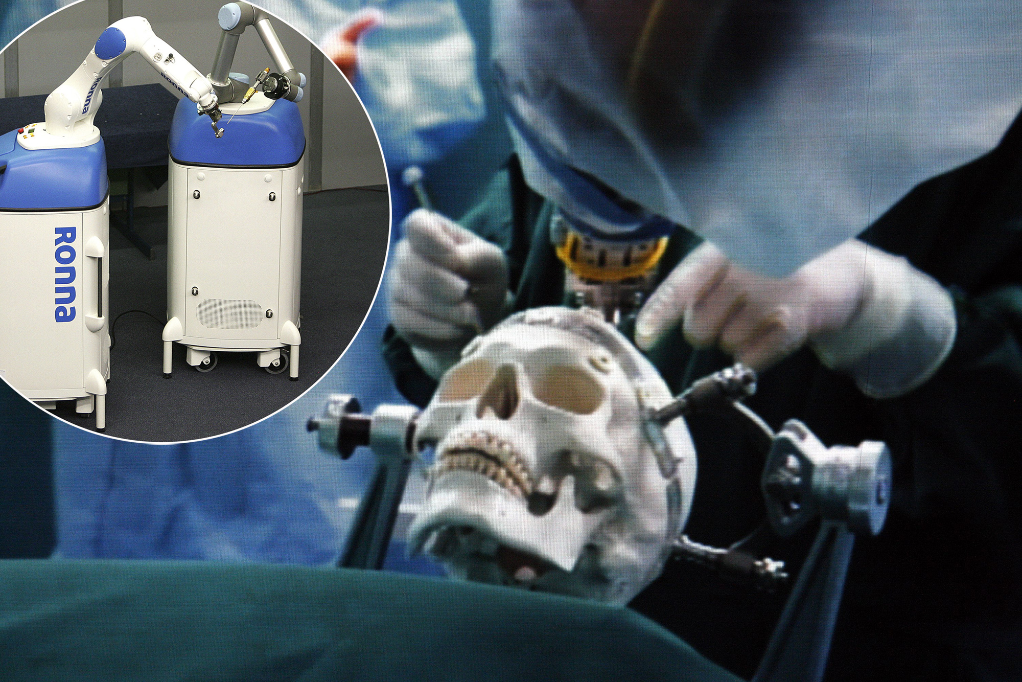 Hrvatska ima iskustva u primjeni robotike u medicini jer je prije pet godina razvijen prvi robot za neurokirurške operacije 