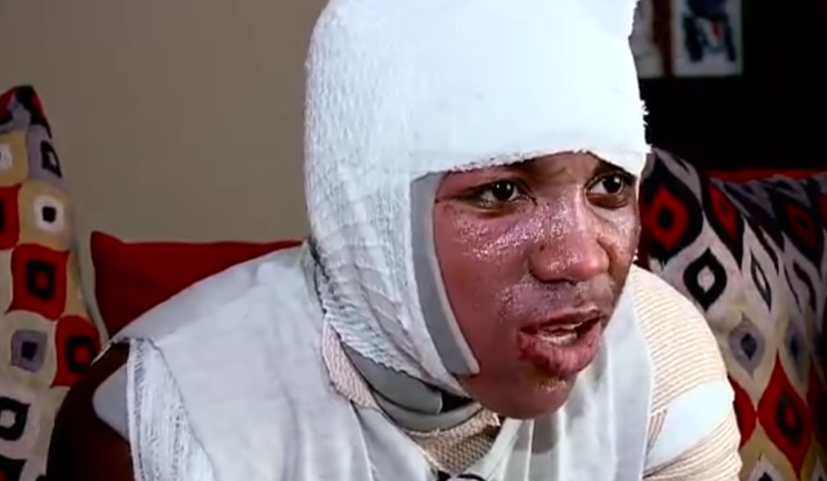 Kyland Clark (15) završio je u bolnici nakon što ga je prijatelj zalio vrelom vodom