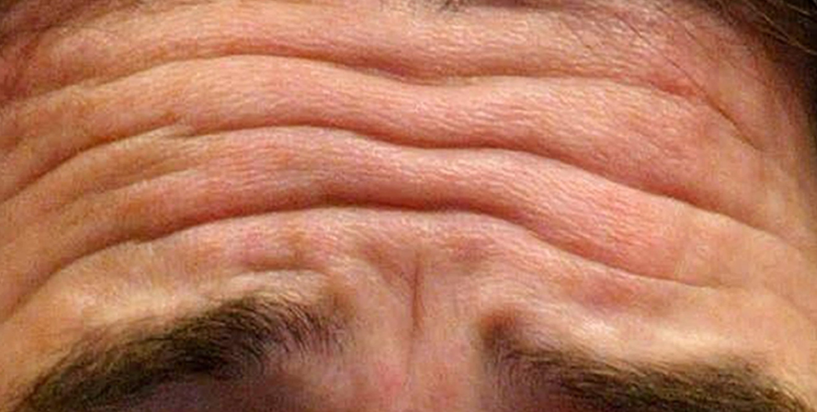 profimedia-0384033740