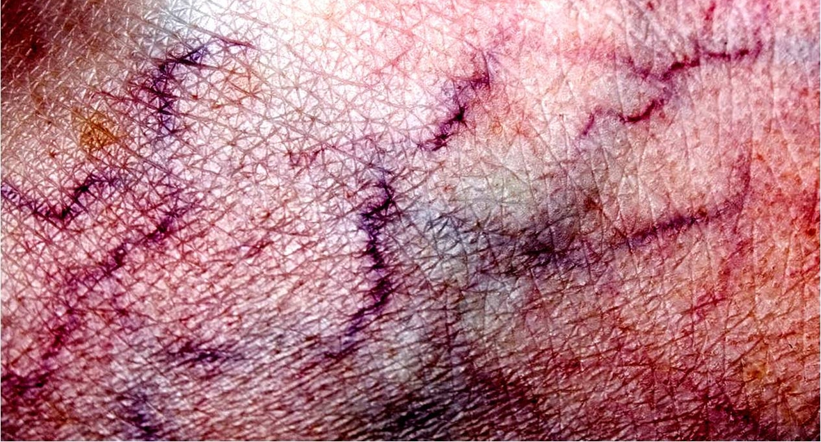 vein-vanish-naslovna