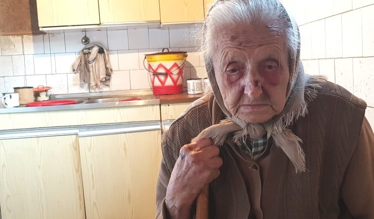 Baka Marija Petrić s vidnim podljevima na licu