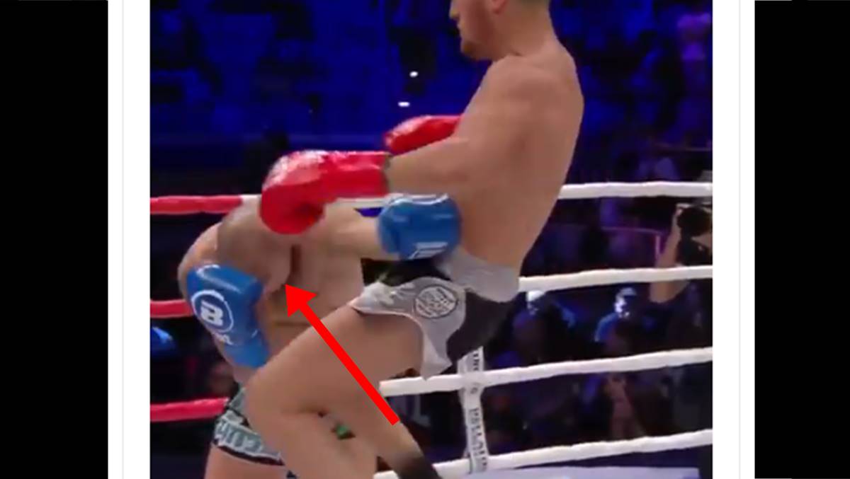 Udarac koji je uzrokovao ozljedu