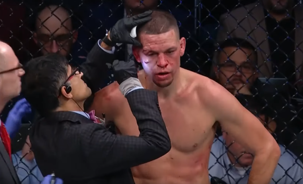 Nate Diaz , doktor, posjekotina