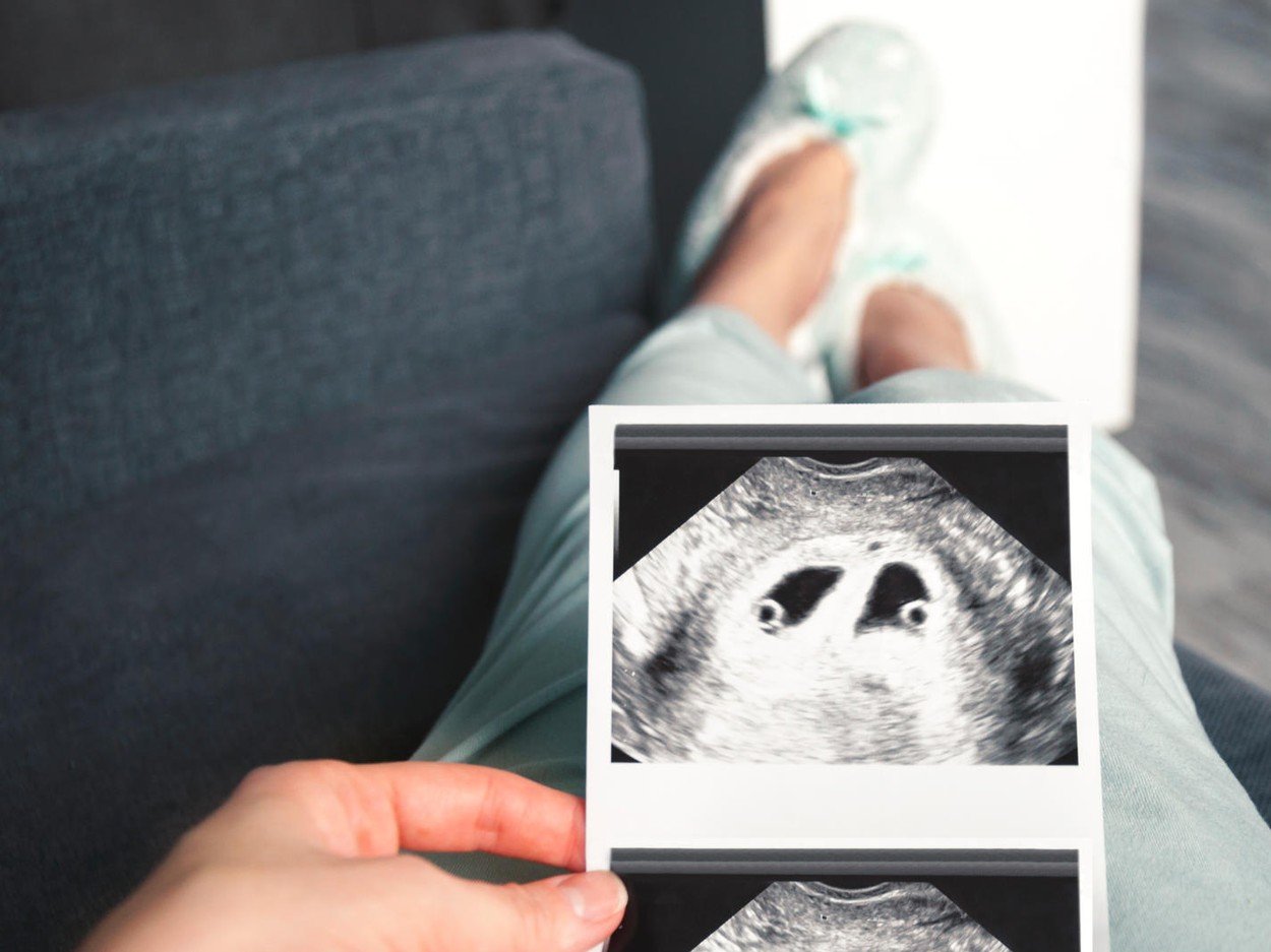 profimedia-0413380021