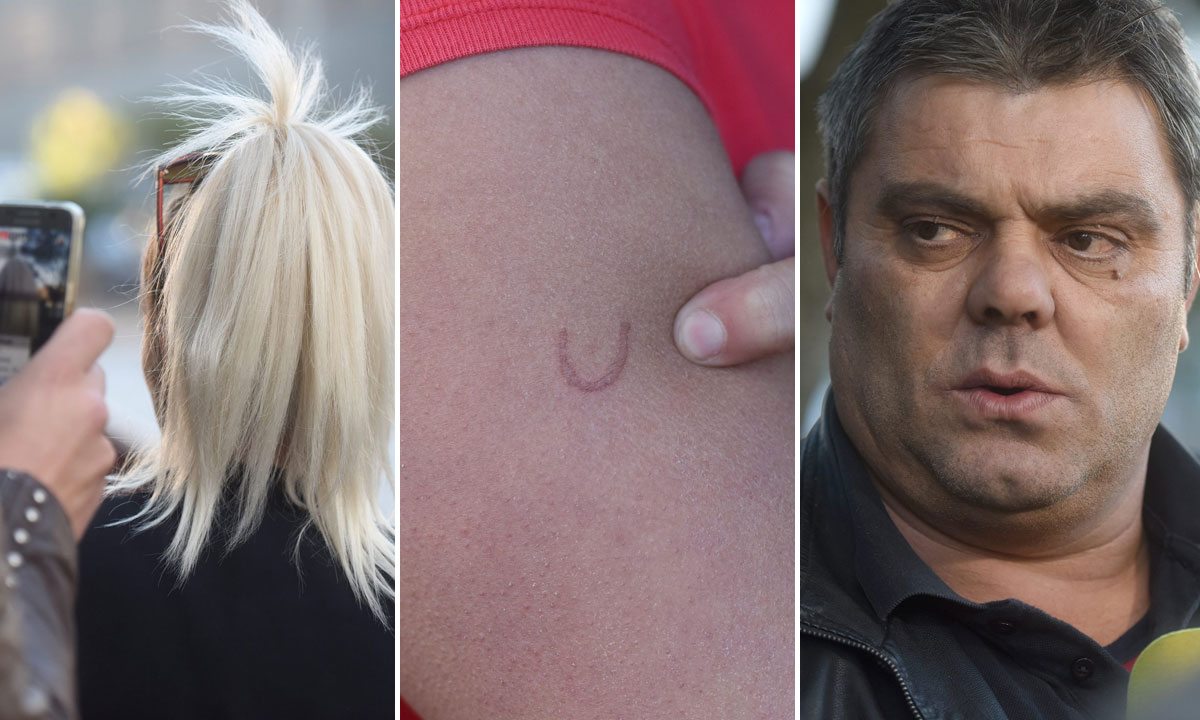 lijevo: 'žigosana' tinejdžerica; desno: Adem Shala, otac tinejdžerice