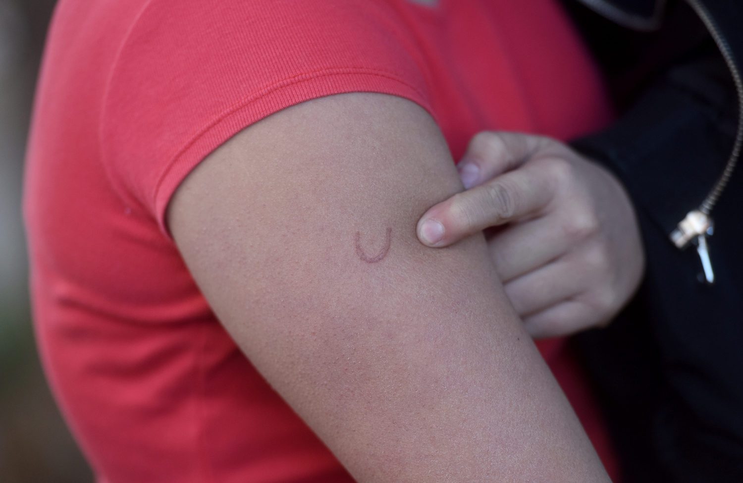 Na fotografiji: ozlijeđena učenica