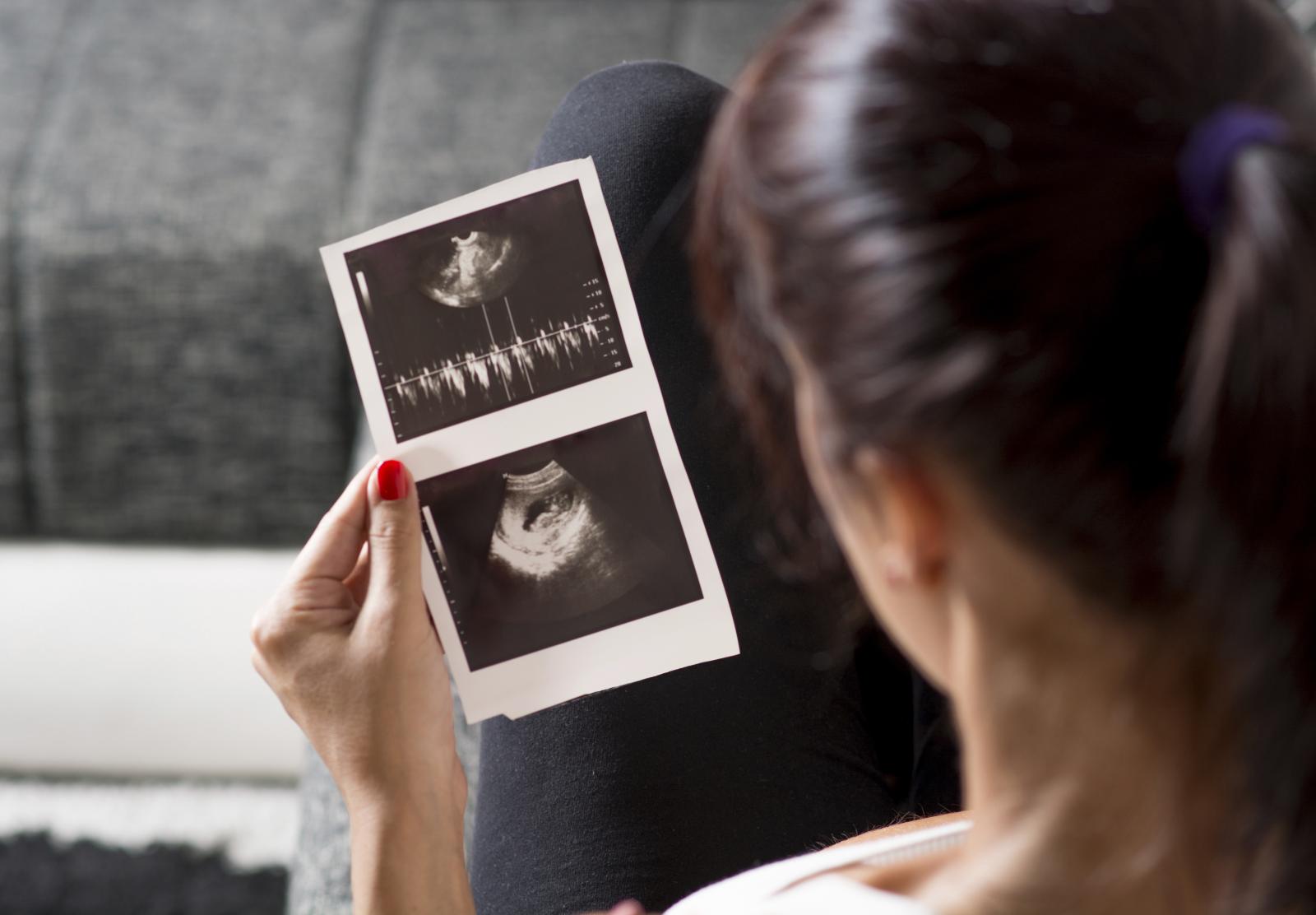 Koliko nam god bilo teško čekati do idućeg pregleda, i naša se Silvija uvjerila kako je to najpametnija ideja.