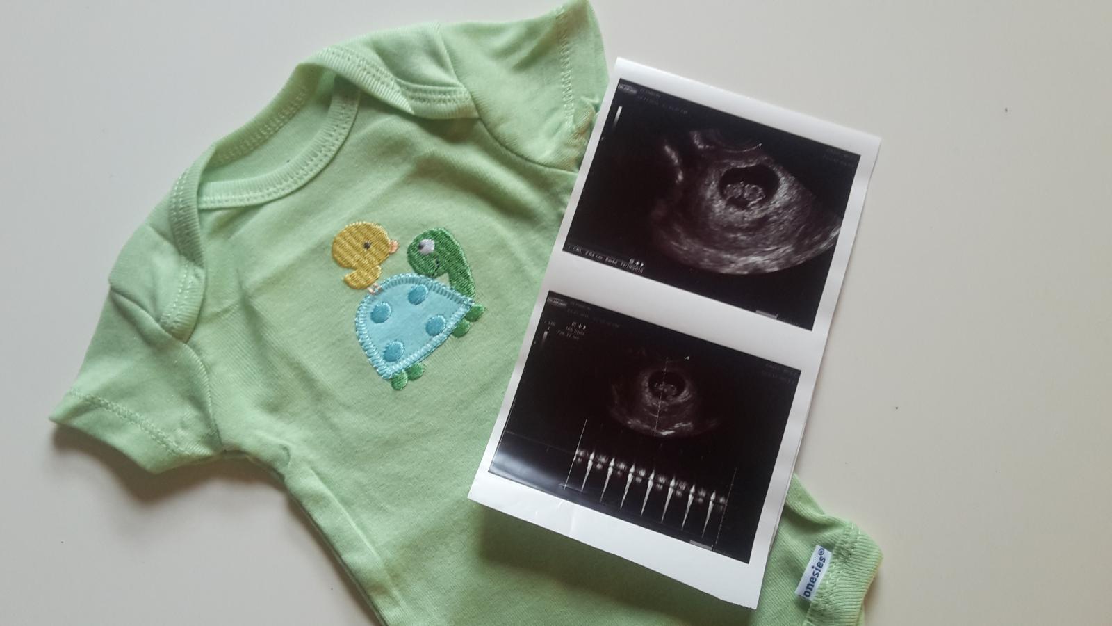 Kad je prvi put vidjela svoje dijete na ultrazvuku, Silviji su potekle suze radosnice.